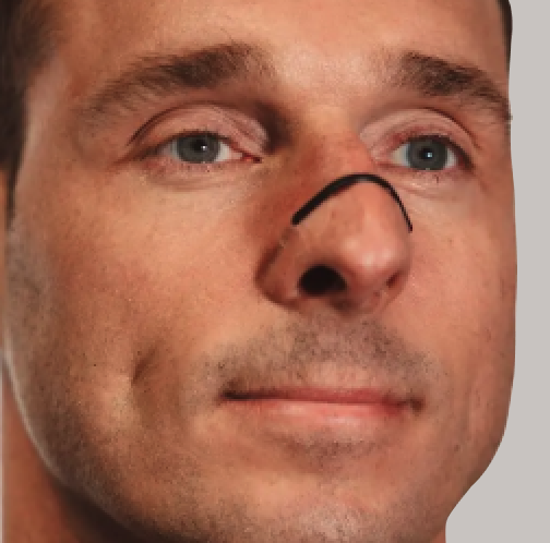 Second Wind Nasal Strips